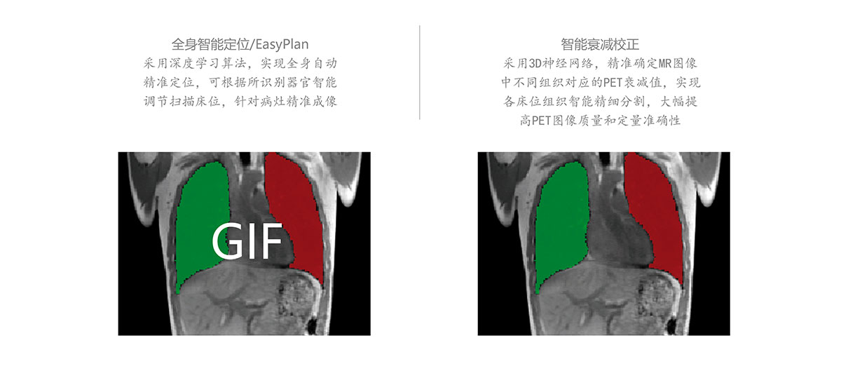 核磁共振(图5)